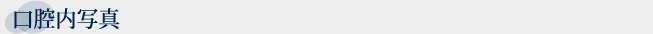 口腔内写真