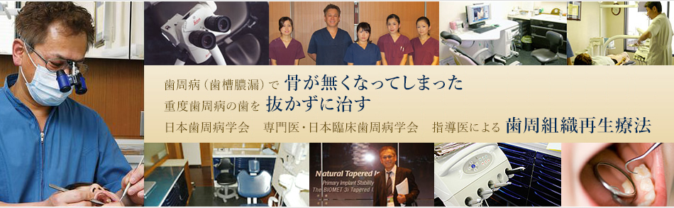 名古屋の歯周病治療のことならさぶり歯科へ